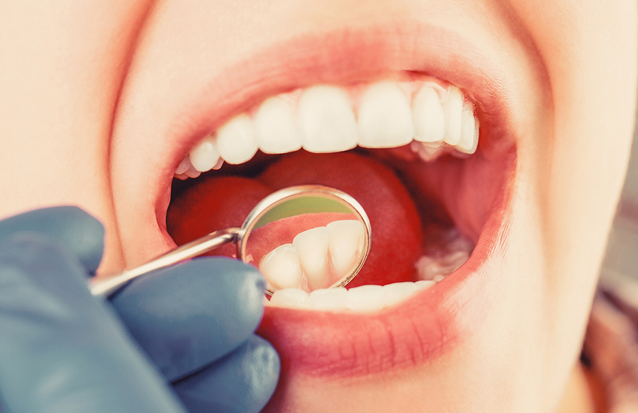 Discover the Top 5 Cosmetic Dentistry Procedures That Can Transform Your Smile
