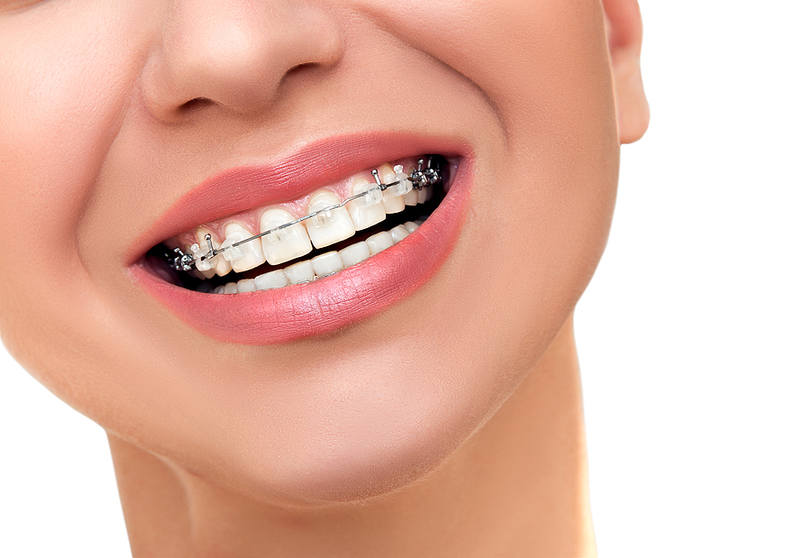 Achieve a Perfect Smile with Orthodontics in Tomball, TX: Comprehensive Care for All Ages