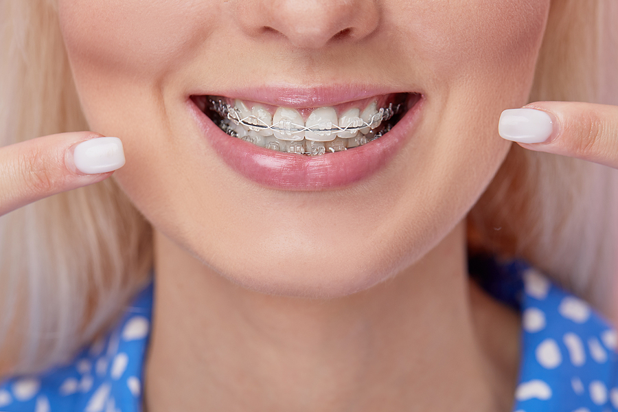 Achieve a Straighter Smile with Advanced Orthodontics